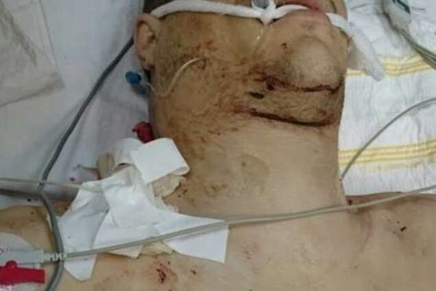 Прооперированный боец АТО