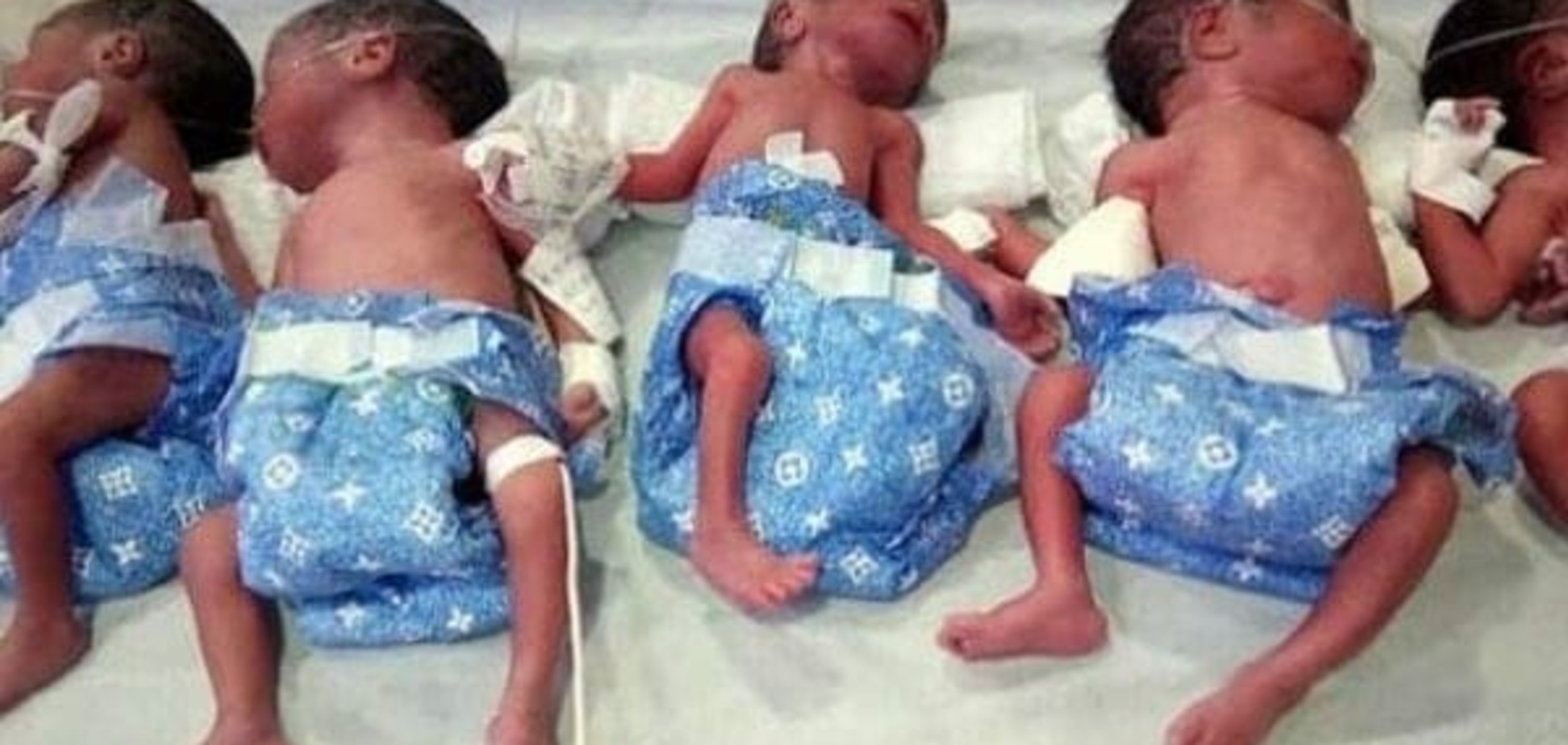 Женщина родила пять близнецов неожиданно для себя  (фото, видео)