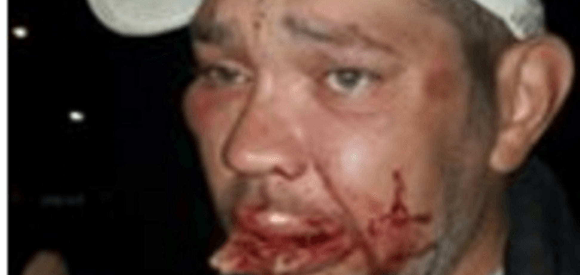 В Киеве банда с битами нападает на прохожих