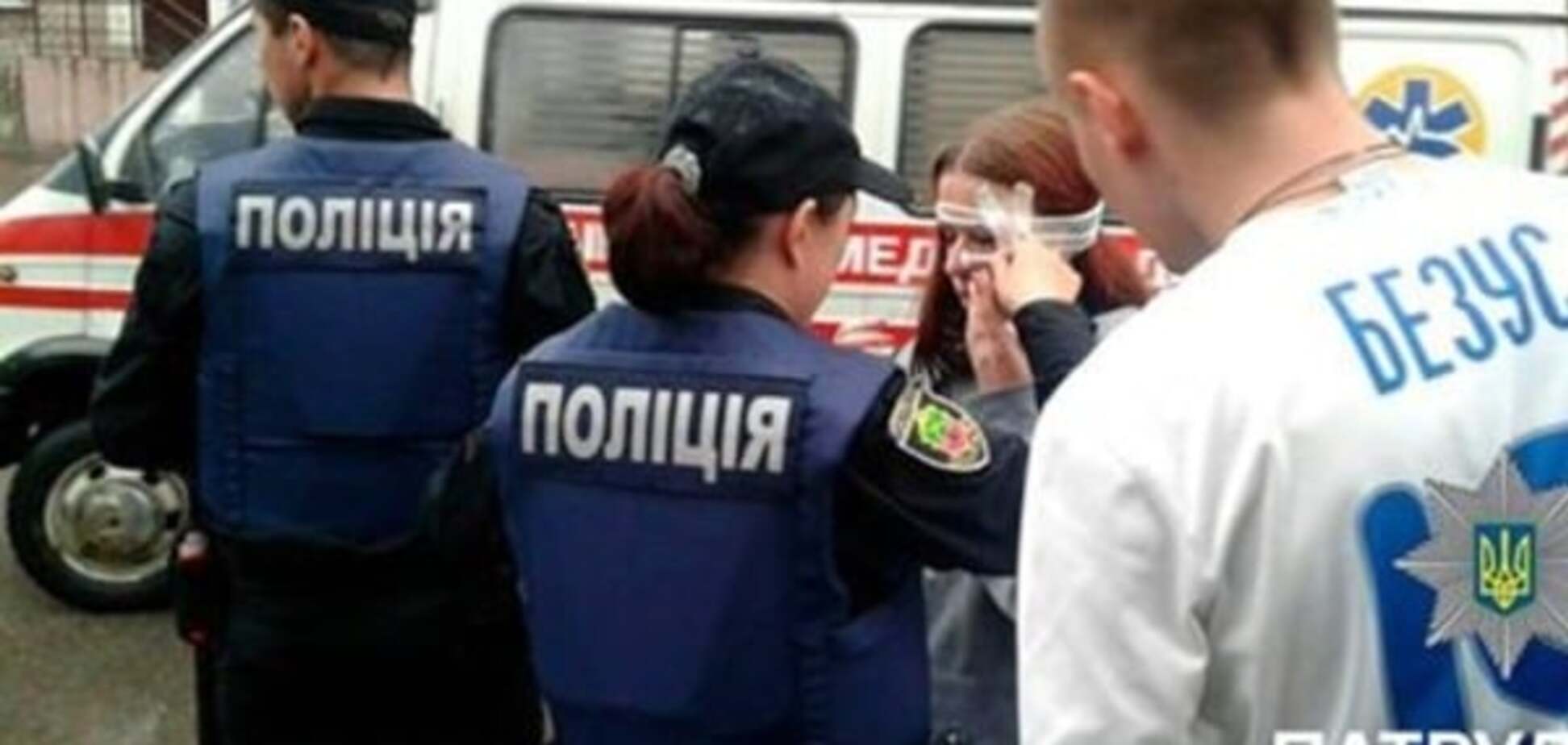 Болельщице 'Днепра' разбили голову после скандального матча Кубка Украины: жуткие фото