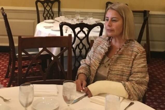 Анна Герман із гіпсом