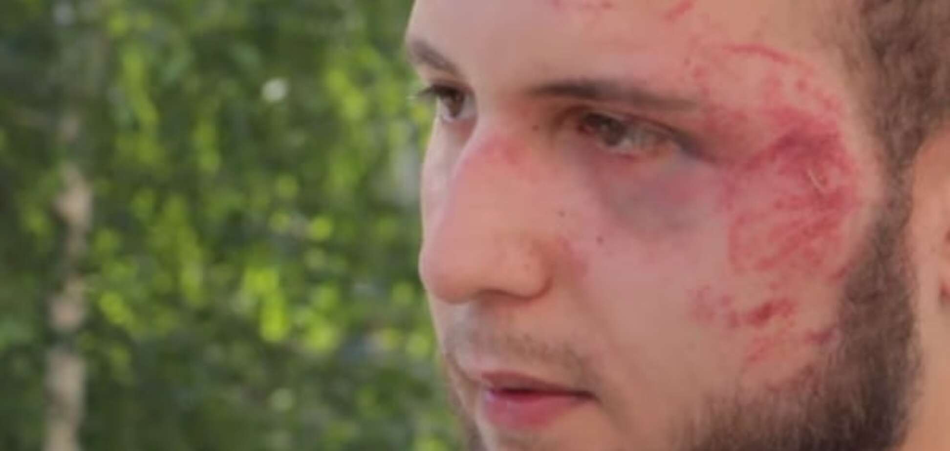 В Запорожье избили журналиста
