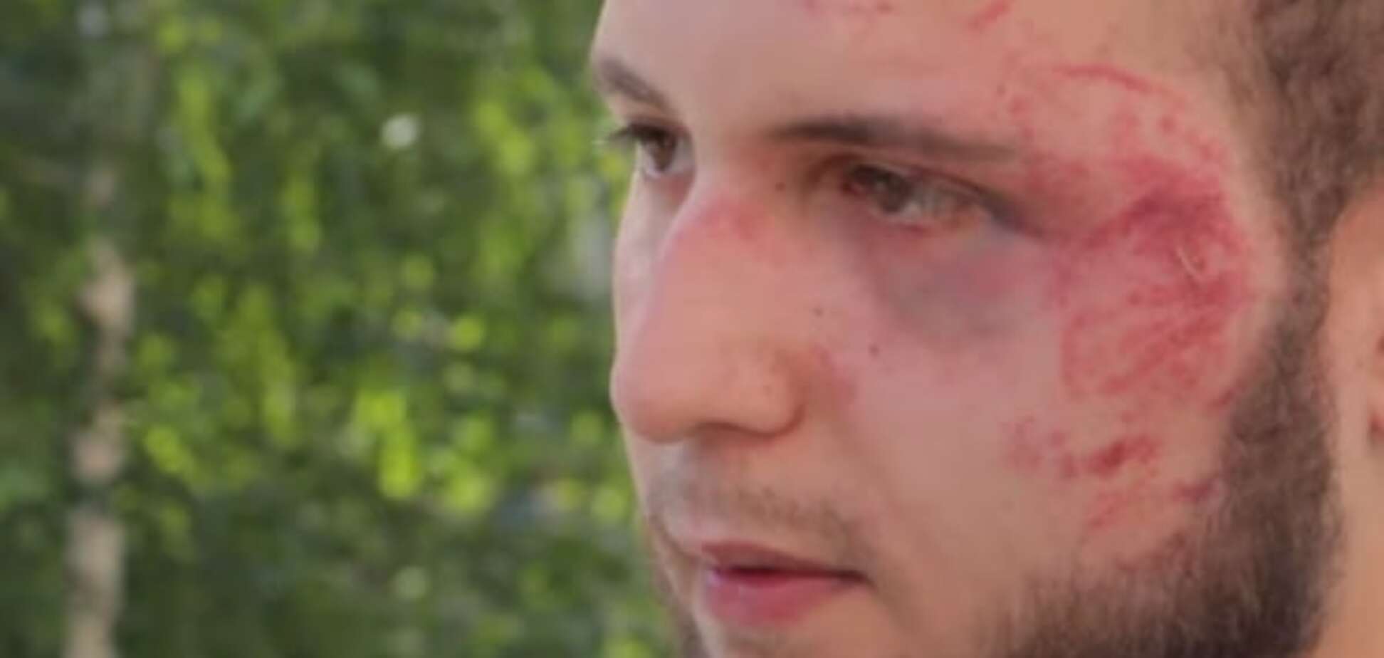 У Запоріжжі побили журналіста