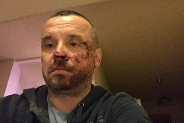 На Донетчине избили председателя областной 'Батьківщини'