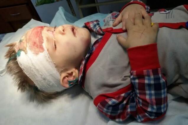 Не помнит кто и откуда: в Одессе нашли покалеченного ребенка. Опубликованы фото