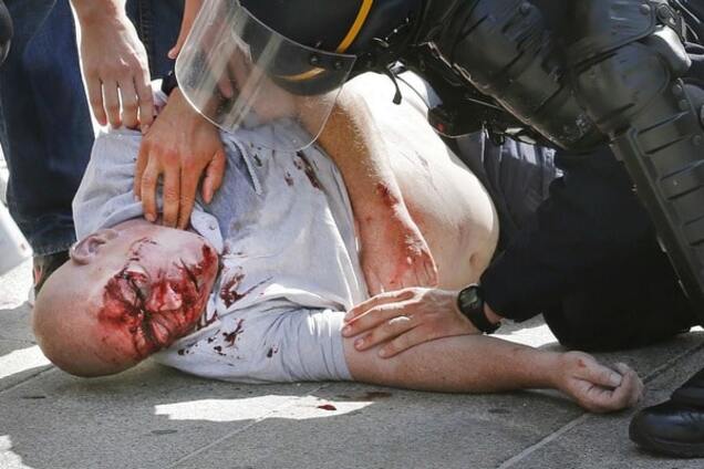 Побитый болельщик