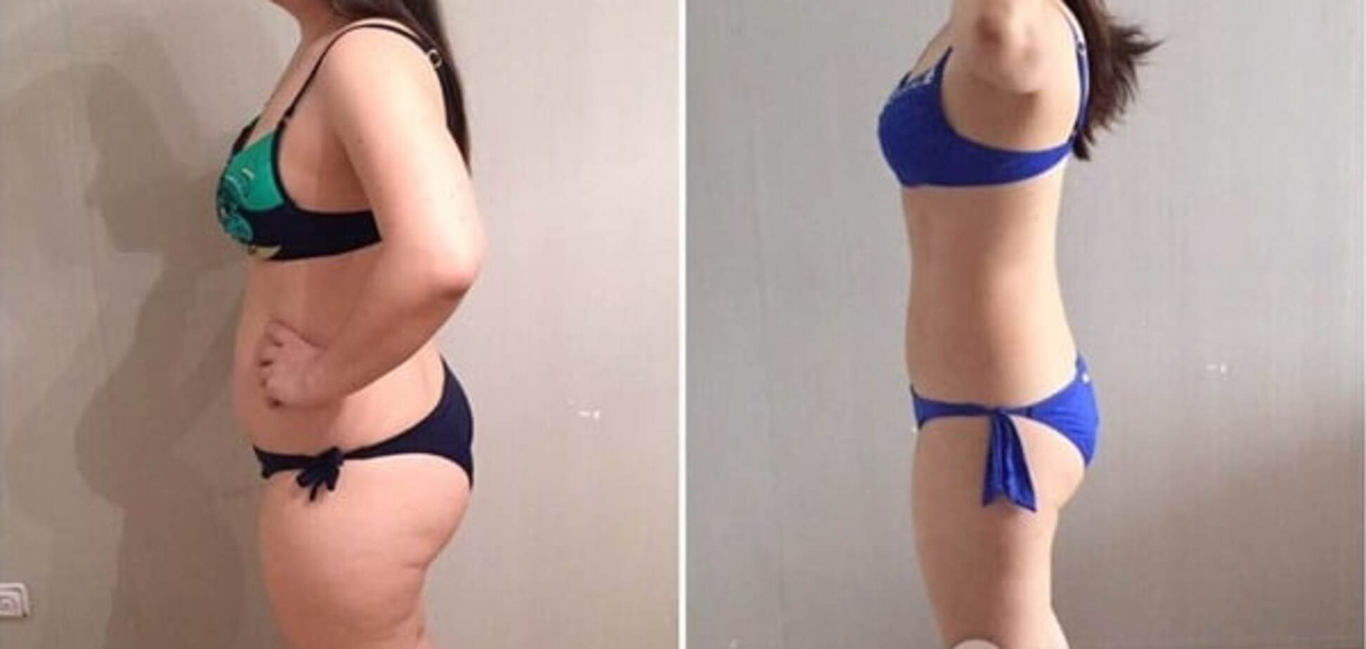 Реальное похудение: истории девушек с невероятной силой воли