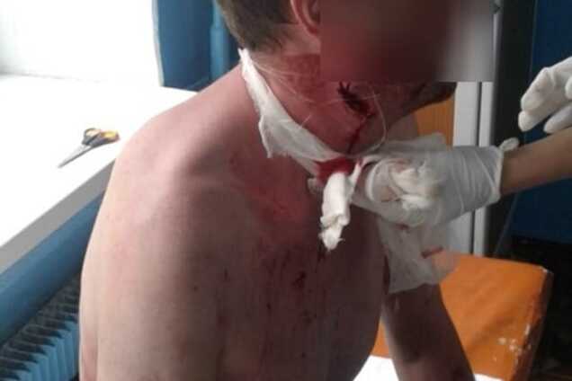 Самоубийство на улице: на Одесщине мужчина перерезал себе горло на глазах у прохожих. Фото +18