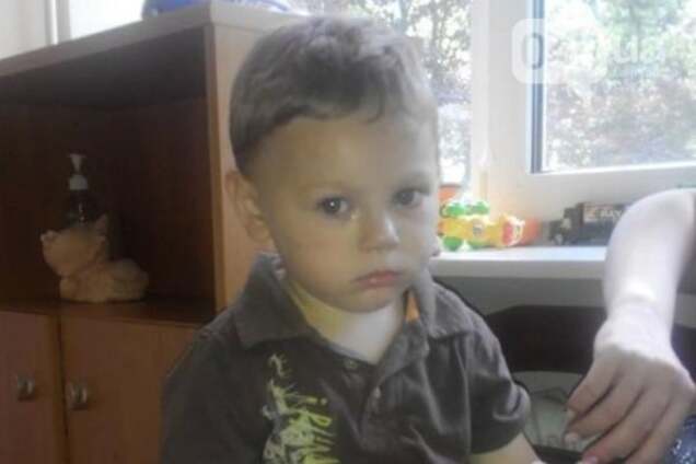 В Одессе нашли еще одного избитого малыша: полицейские просят помочь опознать