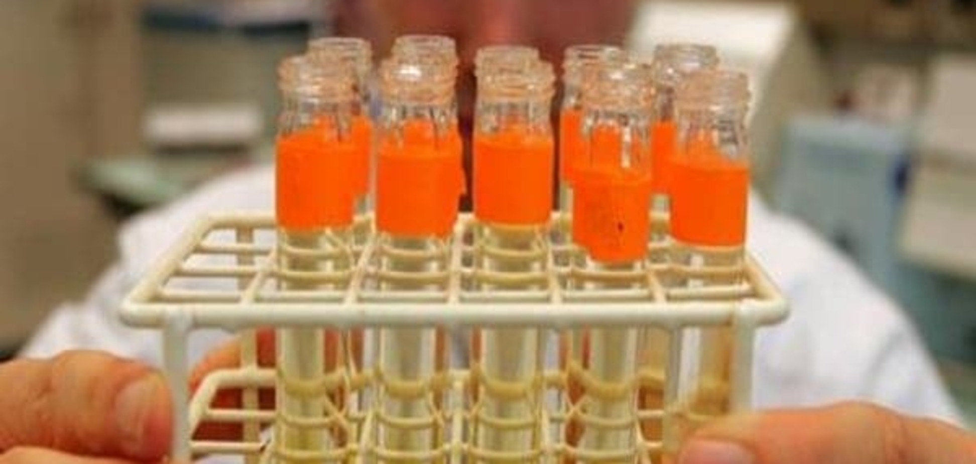 Допінгові скандали в Росії: до чого тут держава?