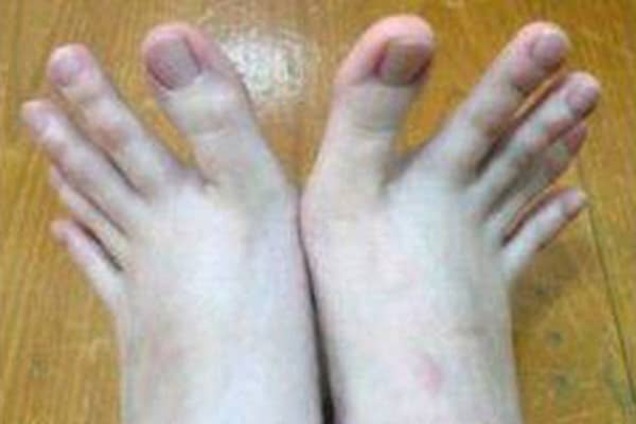 Пальцы на ногах