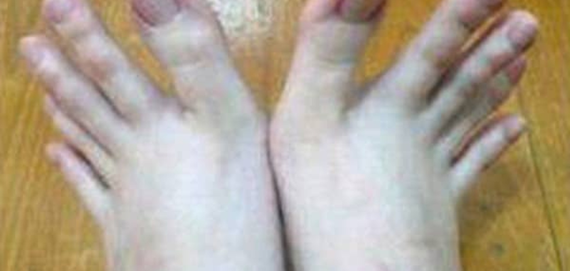 Пальцы на ногах