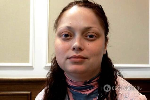 Дівчина з 'синдромом метелика': з того світа мене повернула мама