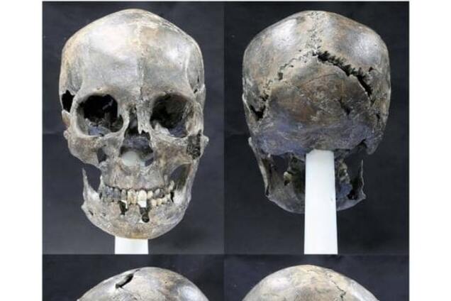 Древняя женщина: в Южной Корее обнаружен череп необычной формы. Фото