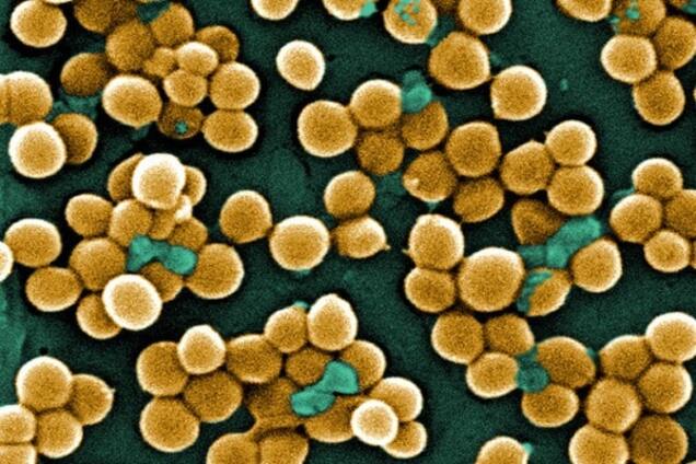 В человеческой слюне впервые обнаружены бактерии, которые паразитируют на своих 'коллегах'