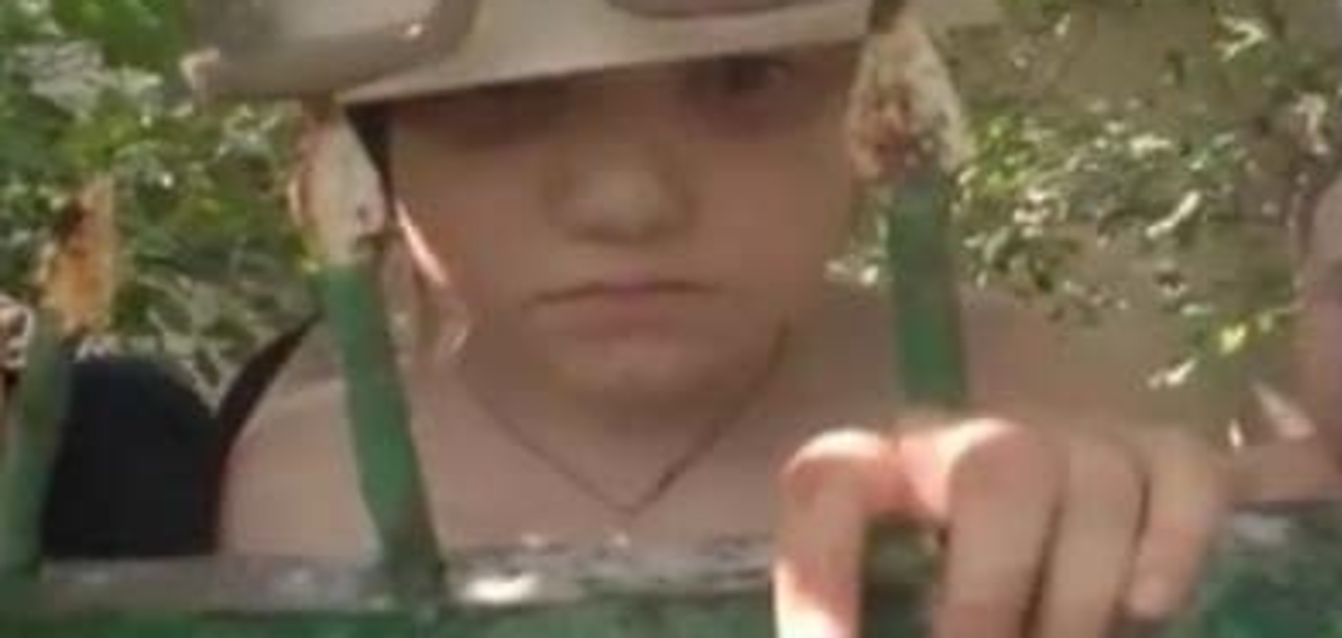 В Николаеве спасли 7-летнюю девочку, которая упала с дерева и проткнула насквозь руку. Видео