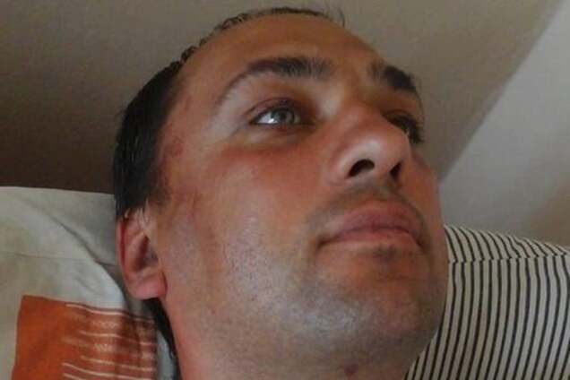 Побитый боец 93-й бригады