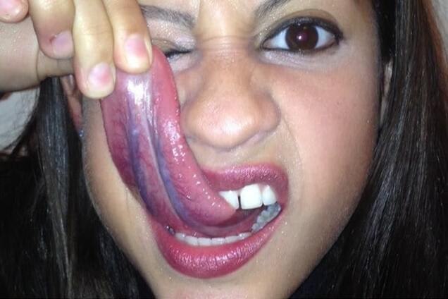 Геркари Бланко