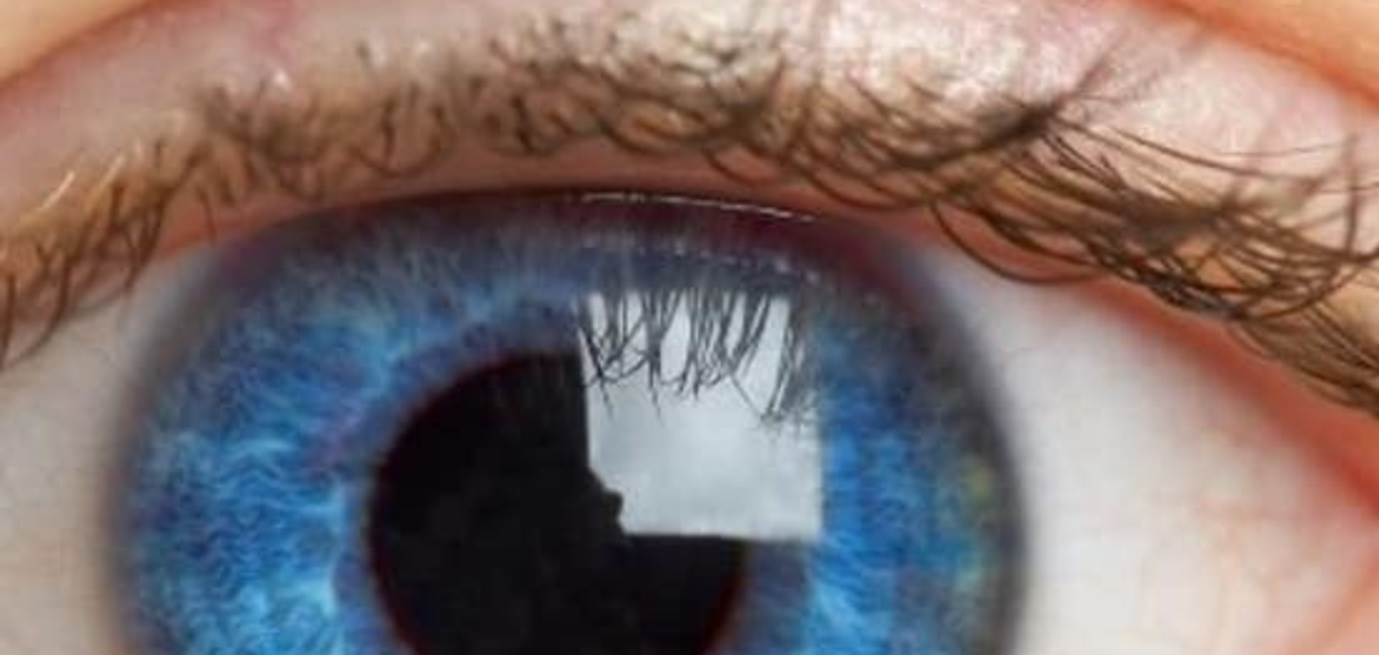 Медики открыли способ раней диагностики глаукомы
