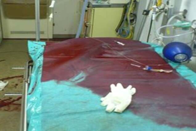 Обстрел Авдеевки