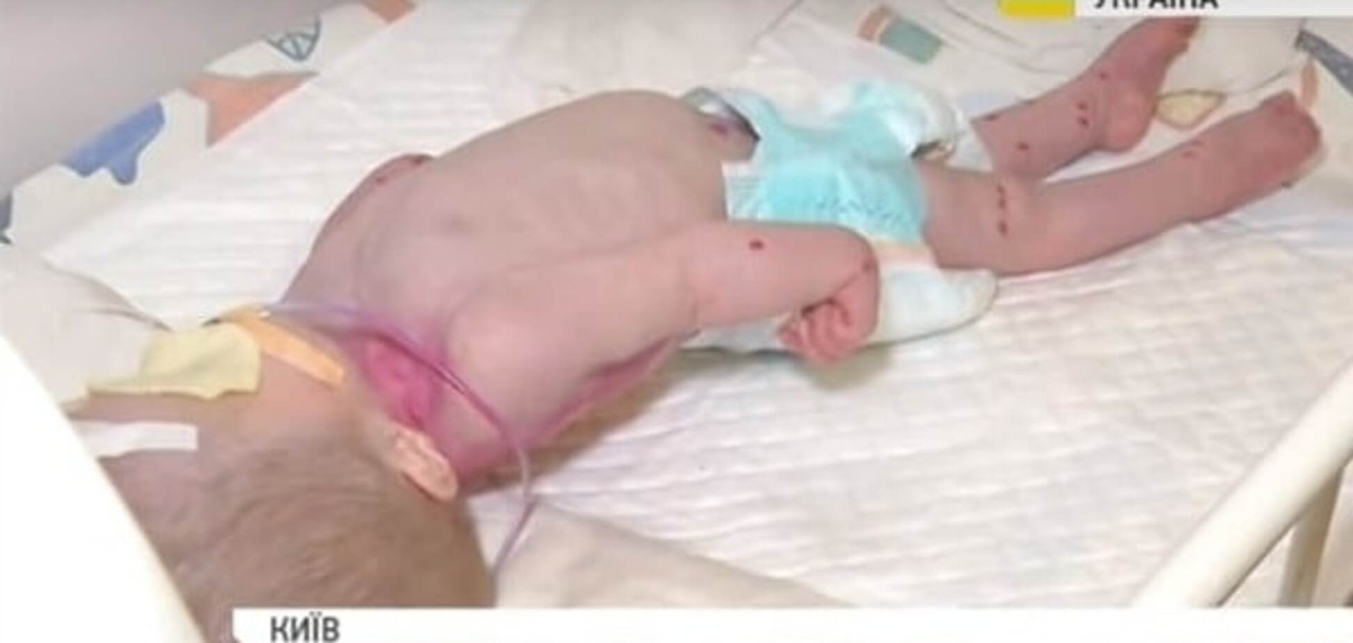 Сирота в киевской больнице