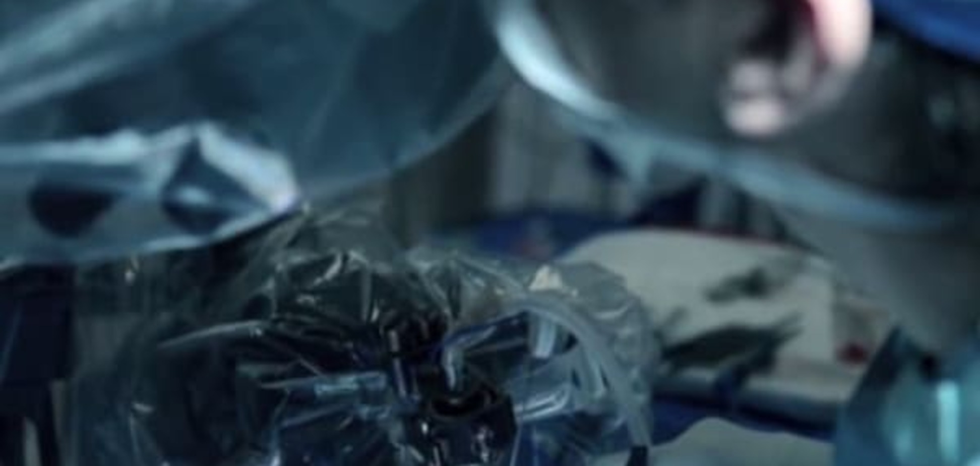 Технологии будущего: ученые работают над созданием эндоскопического робота-хирурга