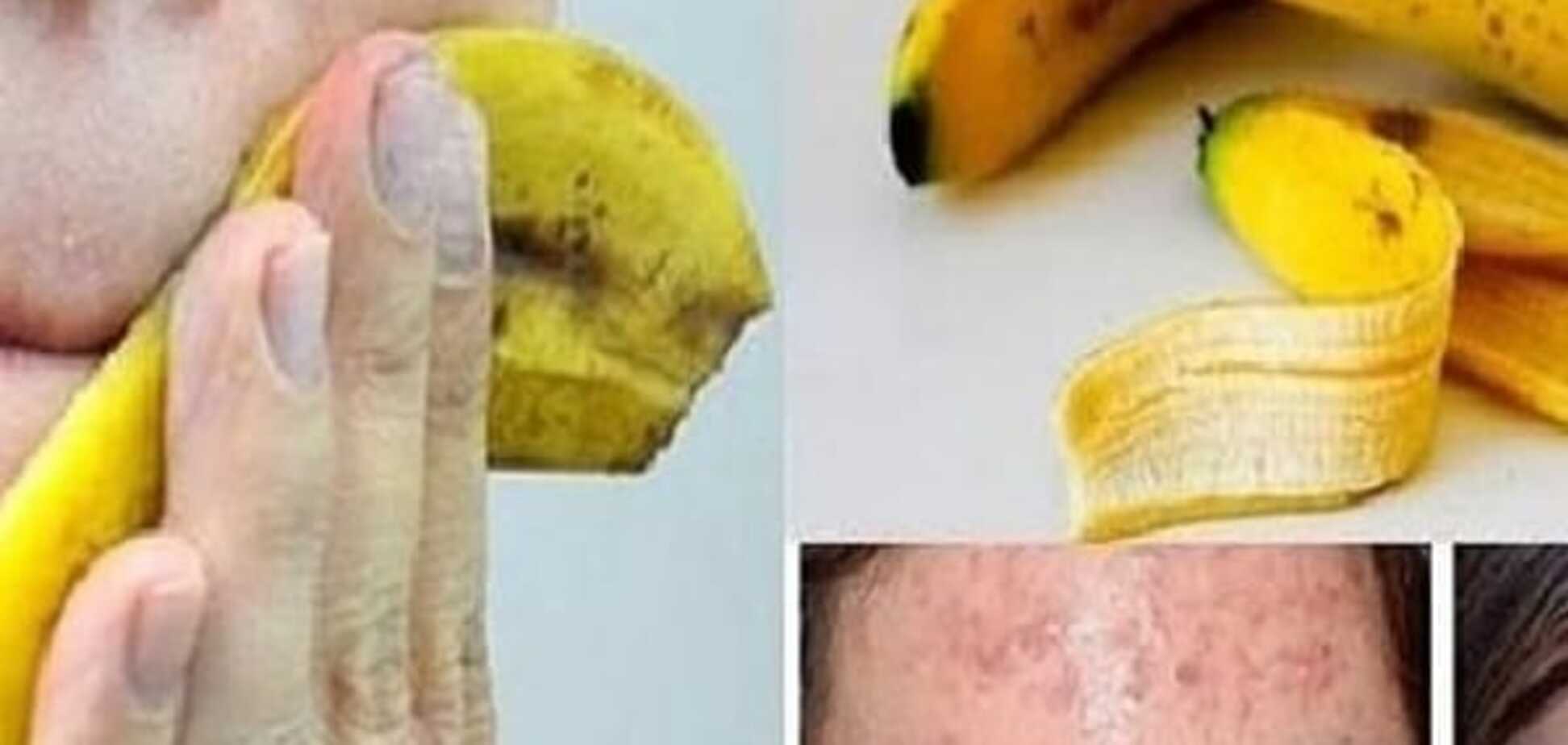 На все случаи жизни: способы применения банановой кожуры