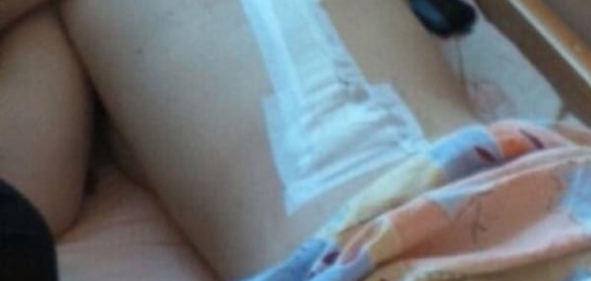 Трагедия на отдыхе:  в Одессе серьезно травмировалась  женщина. Фото