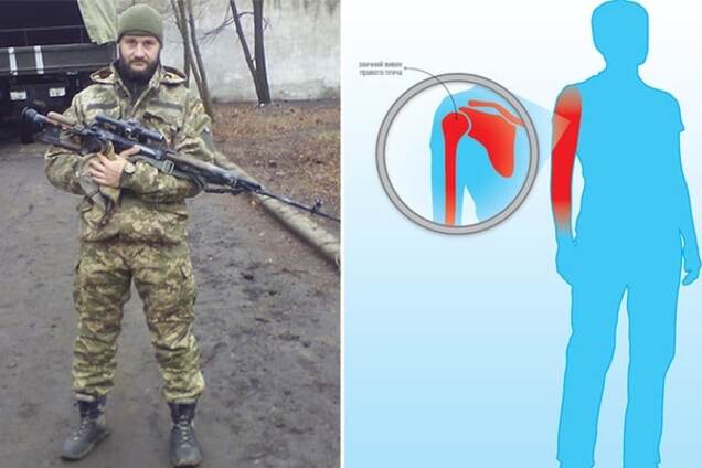 Учасник АТО