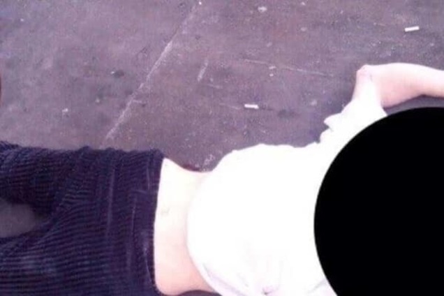 Денег на операцию нет: в Киеве женщина выпрыгнула с 15 этажа из-за болезни
