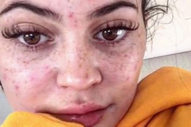 Кайли Дженнер