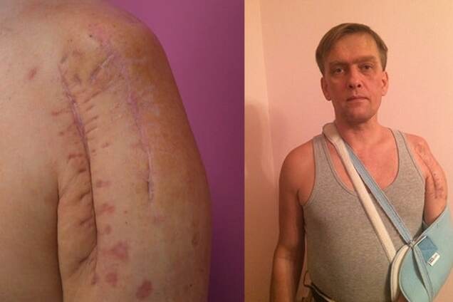 Учасник АТО