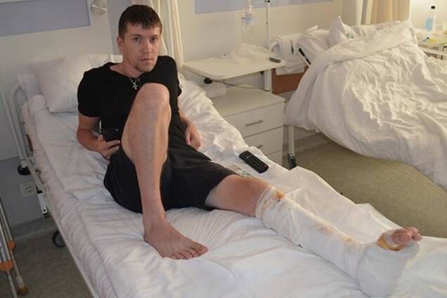 Українські лікарі відновили ногу бійцю АТО методом клітинних технологій