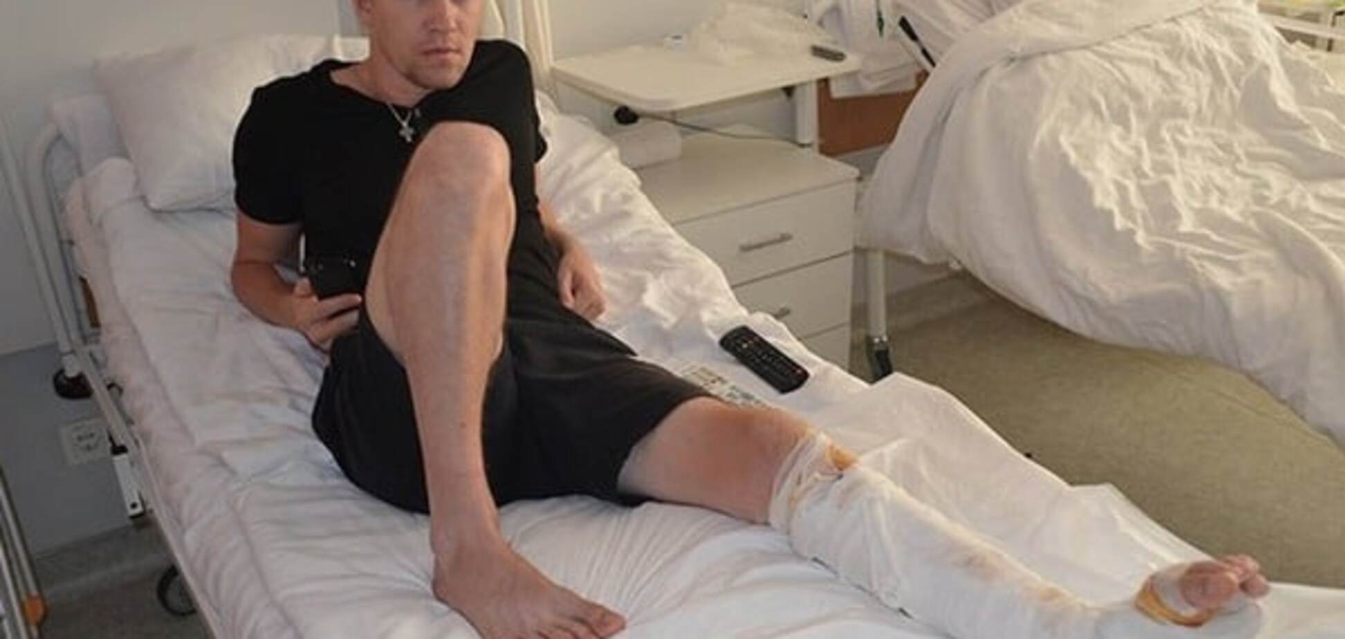 Українські лікарі відновили ногу бійцю АТО методом клітинних технологій