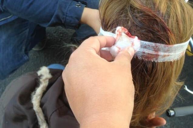 Неожиданно открыл дверь: в Киеве в ДТП пострадала велосипедистка