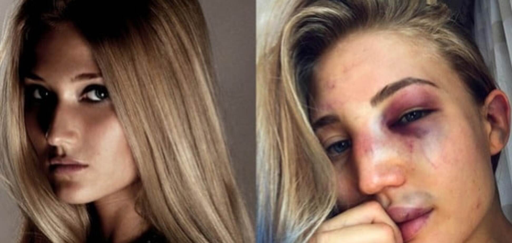 Блогеры показали, как выглядят девушки после боев в ММА: шокирующие фото