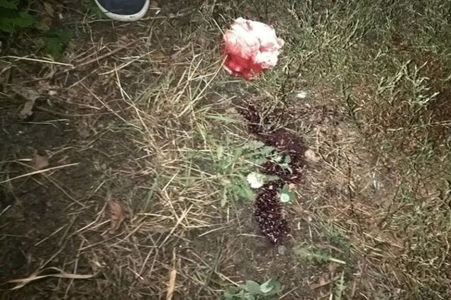 На Киевщине между подростками произошла драка со стрельбой: пострадавший в реанимации