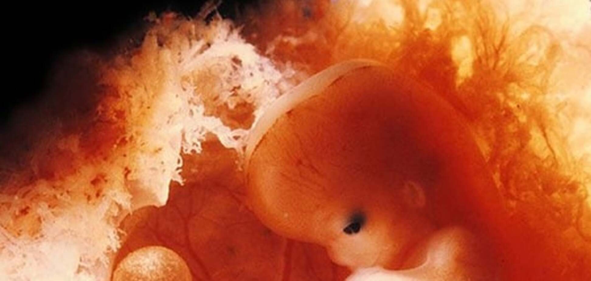 Вплоть до уголовной ответственности: в Польше хотят запретить аборты