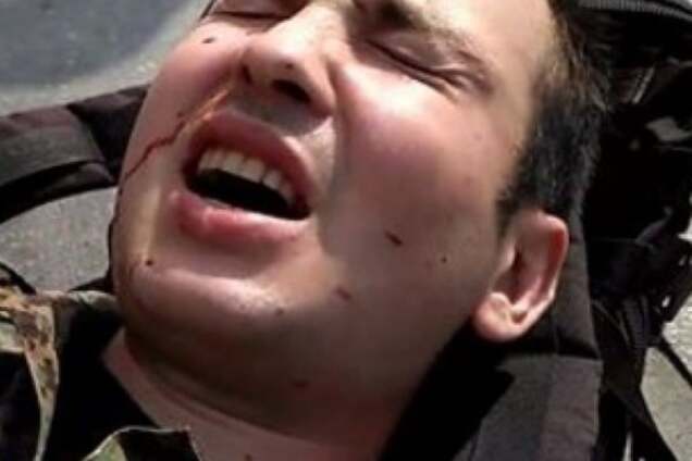 Обычная случайность: у Яроша отреагировали на ранение бойца ОУН в Киеве