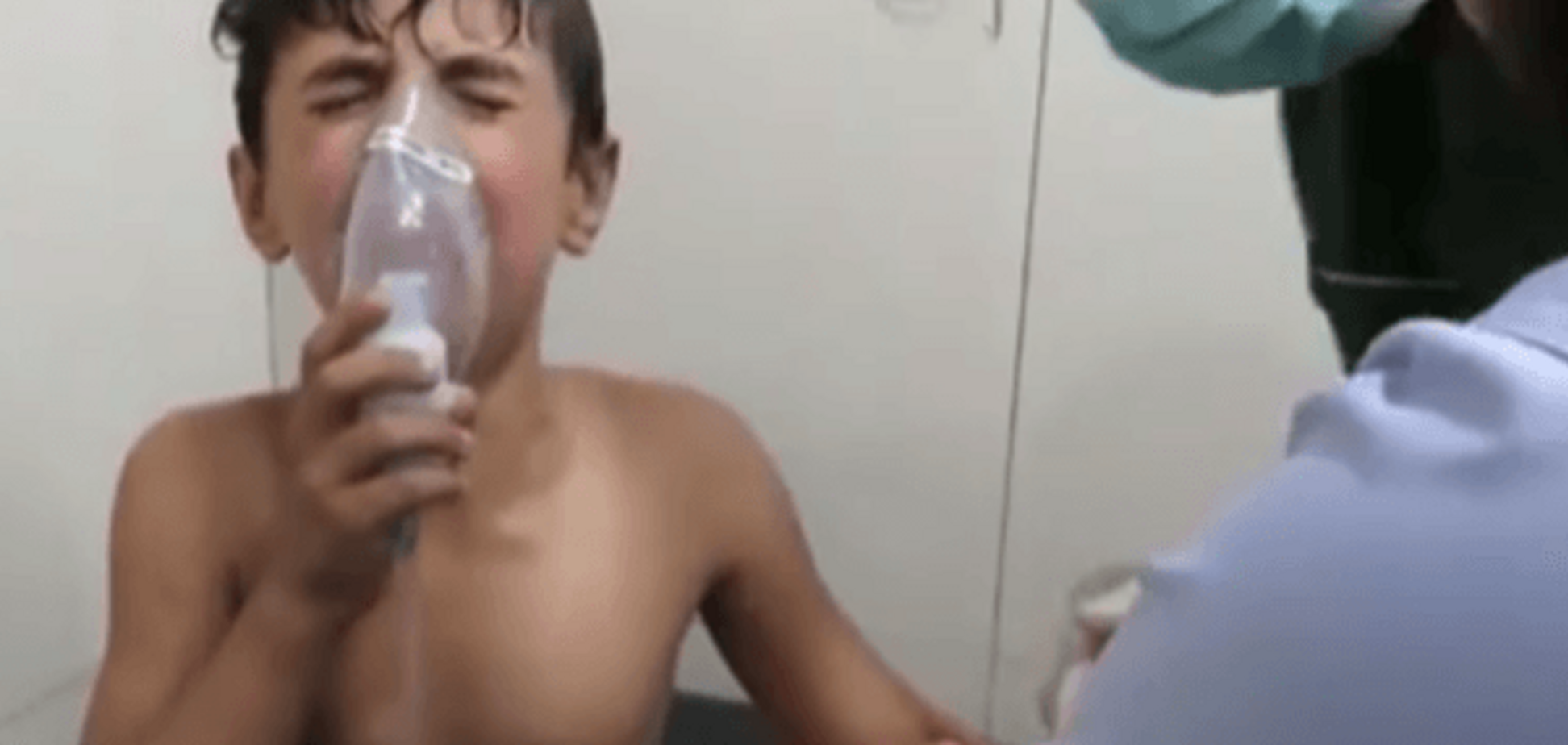 В Сирии сбросили бочковые бомбы с ядовитым хлором: пострадали 80 человек. Опубликовано видео