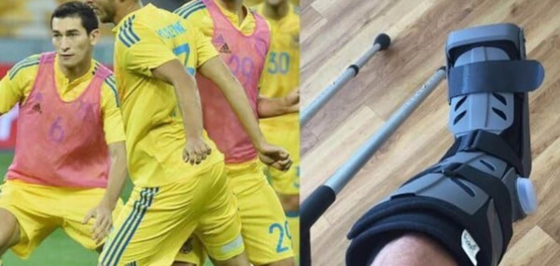 Врачи поставили неутешительный диагноз новичку сборной Украины, которого травмировал Селезнев