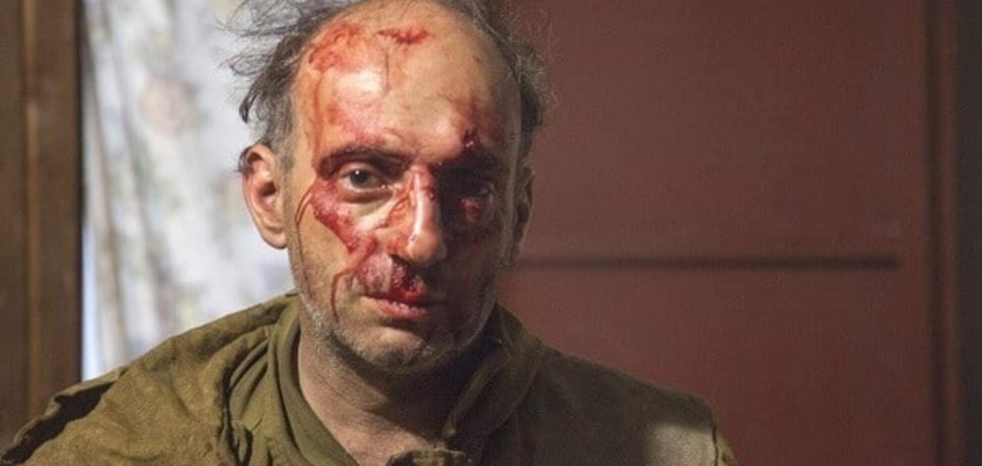 Amnesty International: избиение активистов Greenpeace на Кубани – наступление на свободу объединений