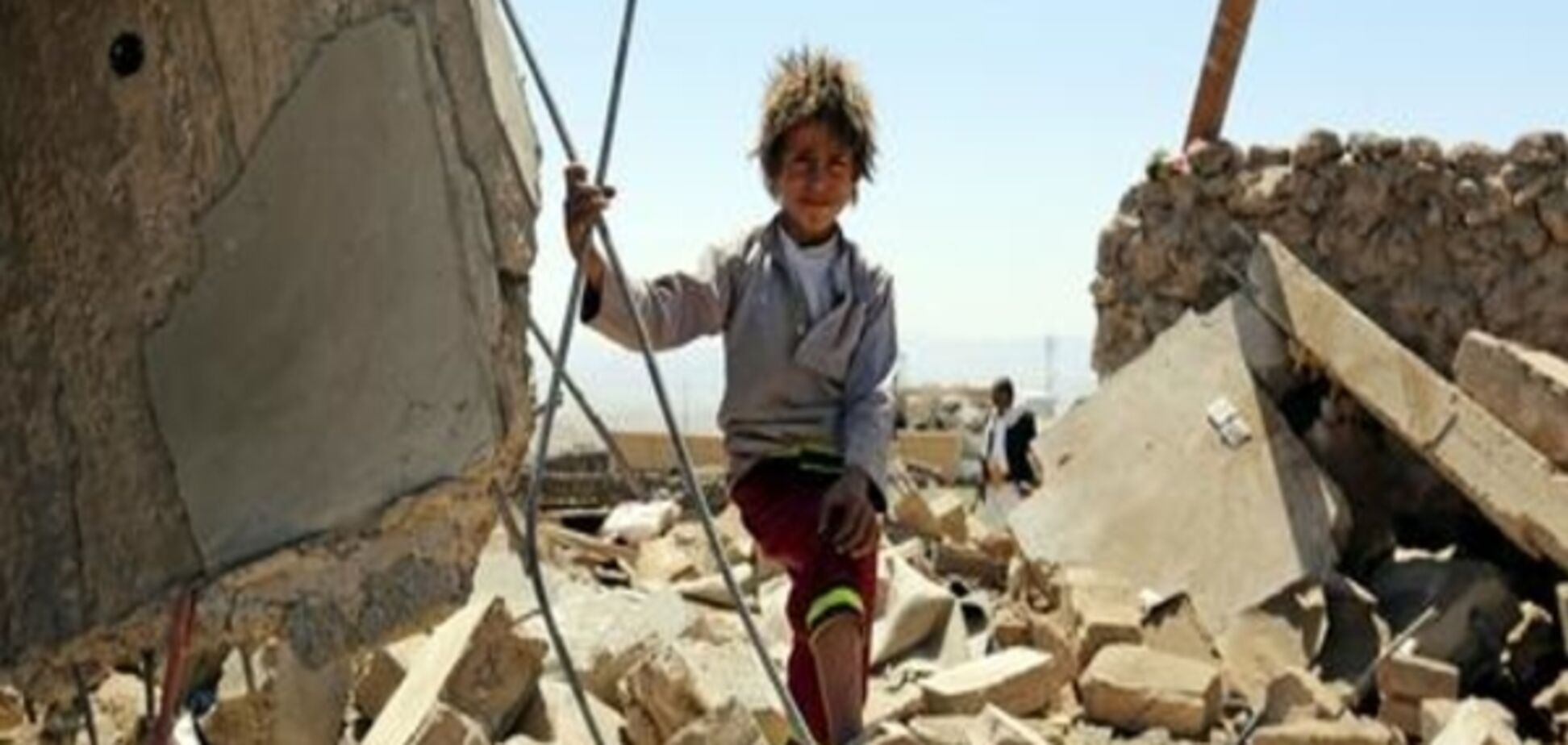 ООН: Через війну в Ємені загинули 1400 дітей