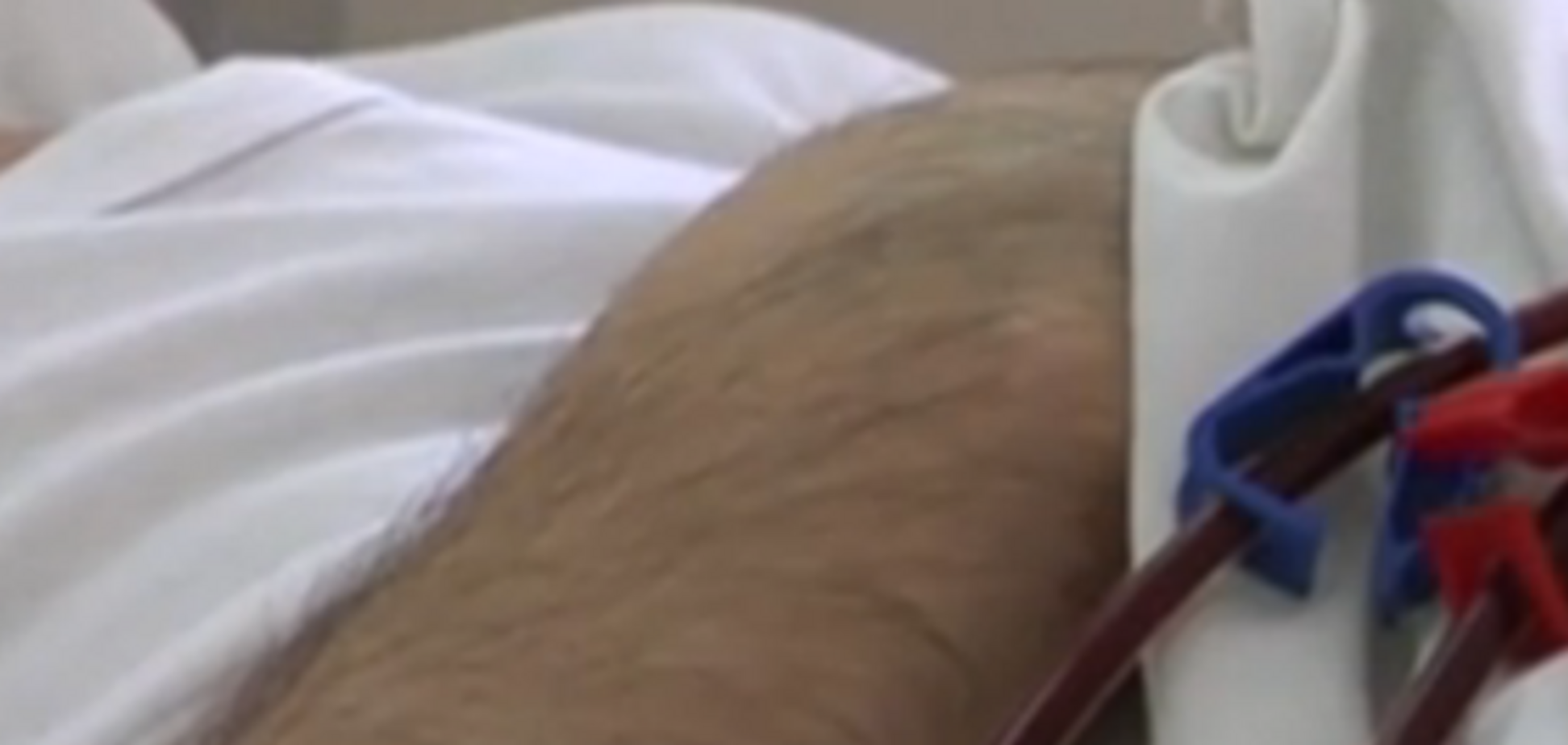 Во Львове обычная операция на носу привела к загадочной смерти