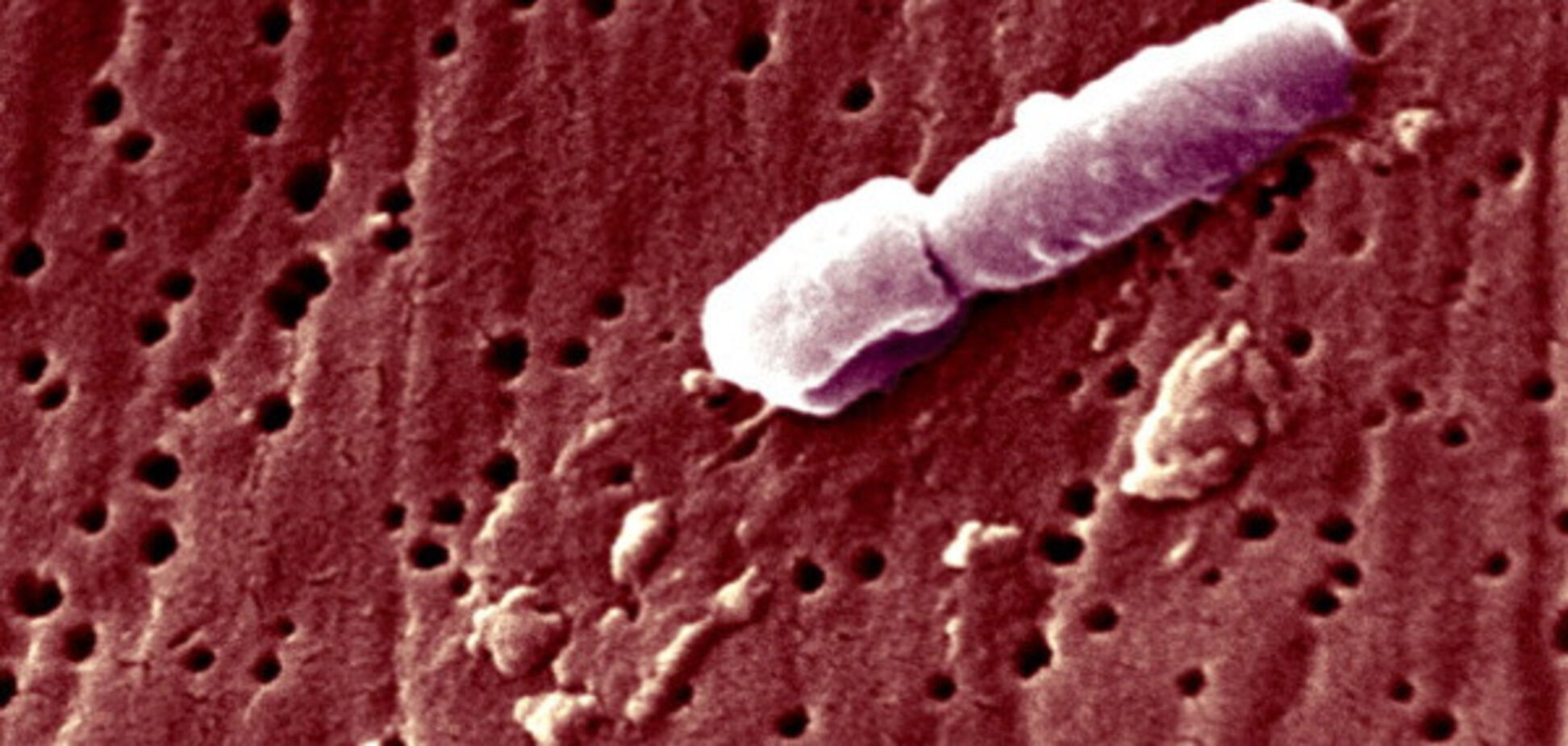 Бактерия Klebsiella pneumoniae