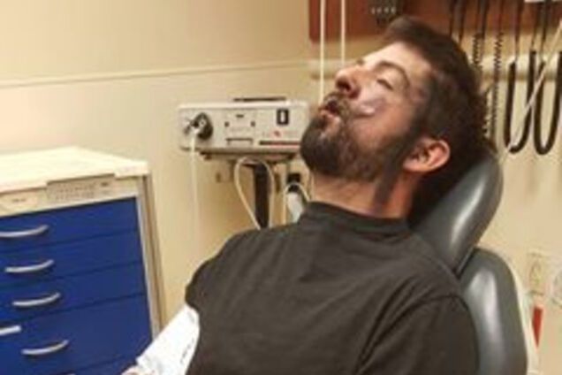 Якобы пострадавший вейпер