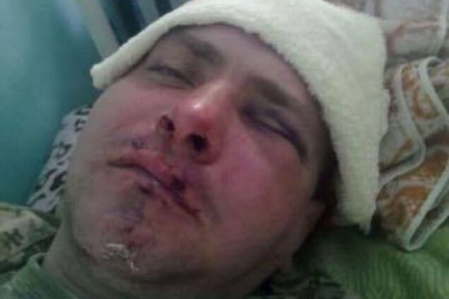 Избитый боец Правого сетора