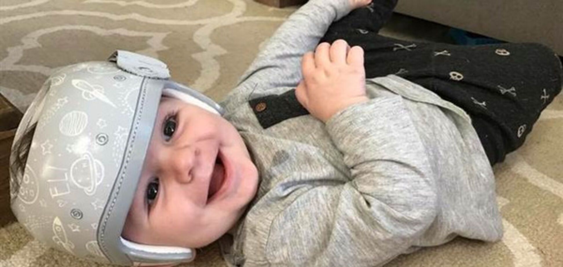 Ярко и забавно: мама сделала так, чтобы медицинский шлем сына вызывал у людей не жалость, а улыбку