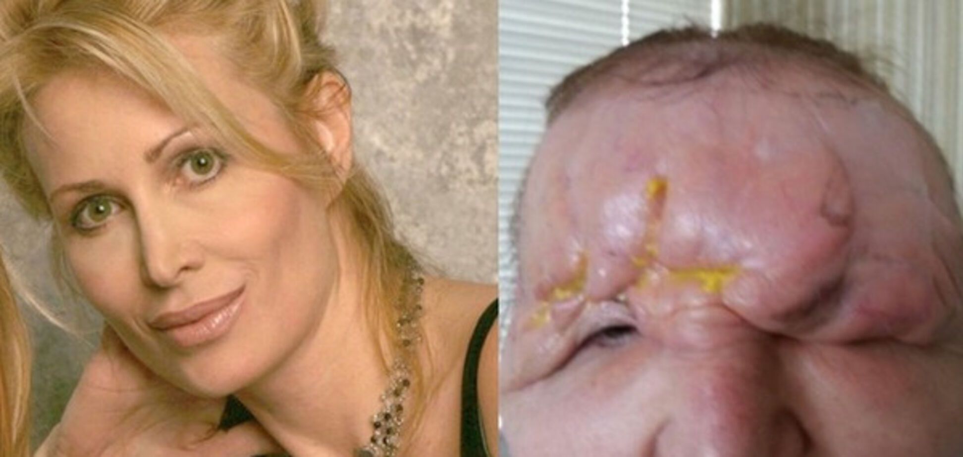 Кэрол Брайан