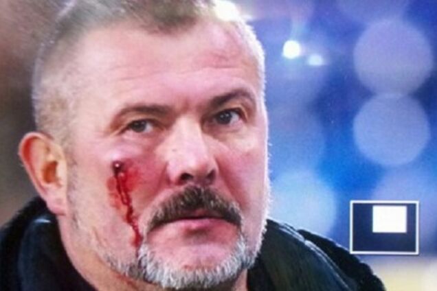 'Хворі люди': нардеп Береза розповів про напад ультрас 'Дніпра'